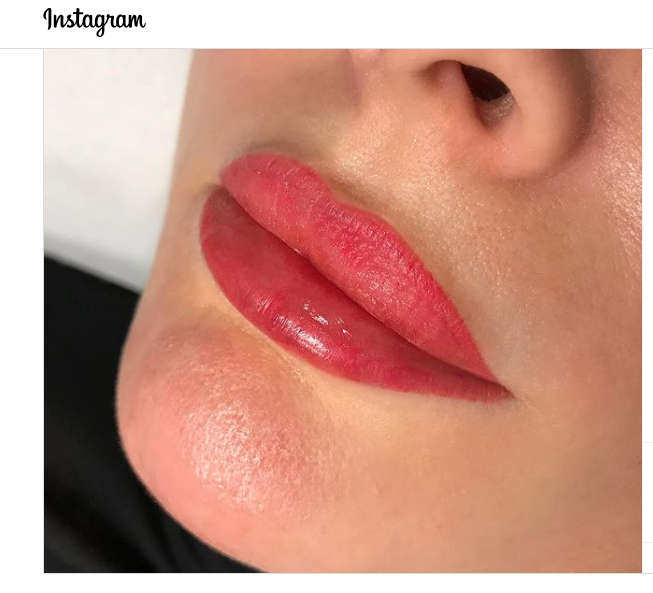 blog photo which is based on lip-contouring