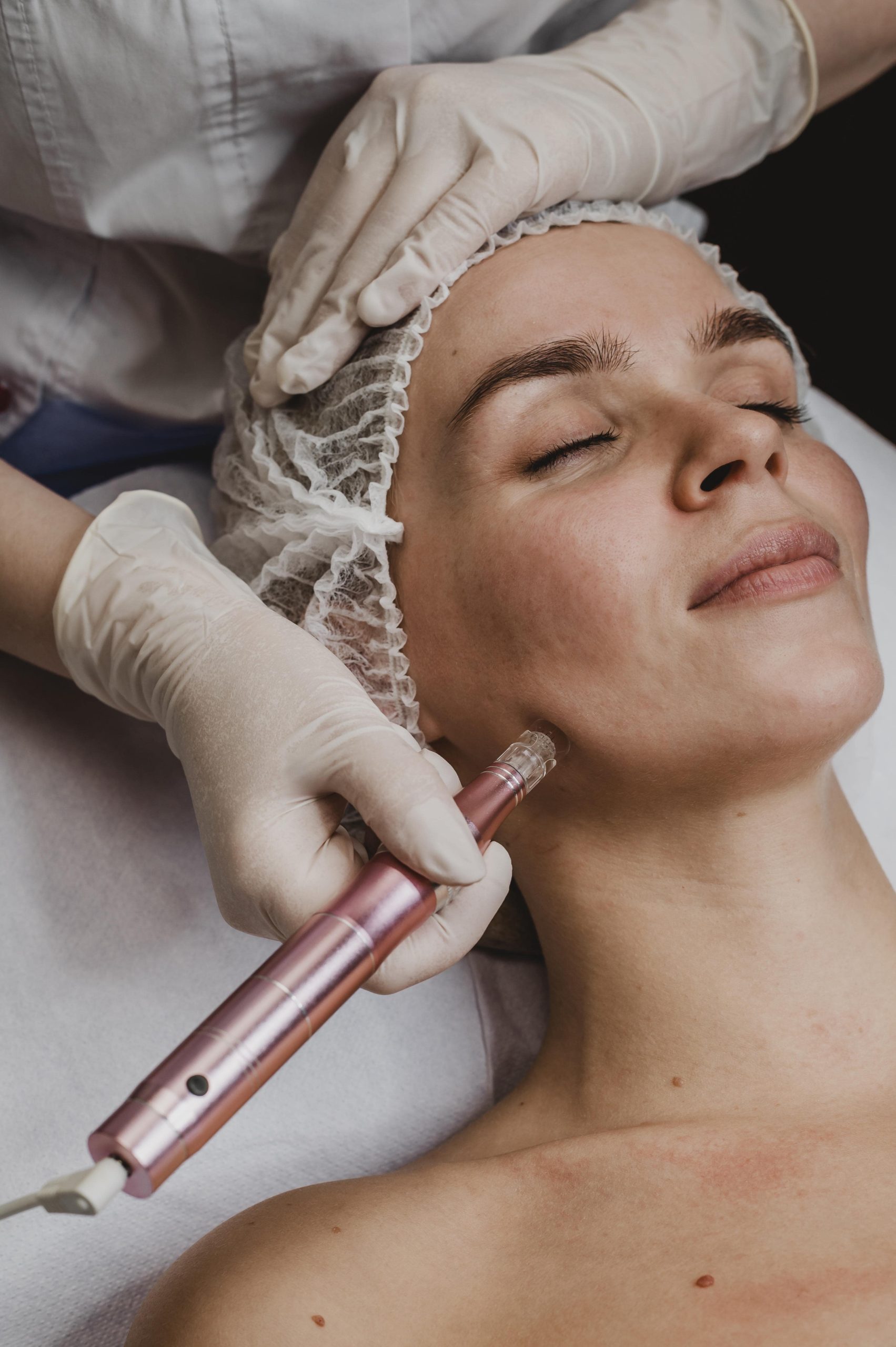Microdermabrasion classes