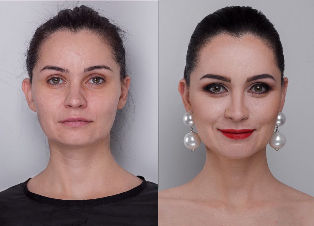 Advantage of Blepharoplasty effect before and after